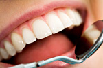 Regular hygiene visits (cleanings) prevent periodontal disease, cavities and other issues