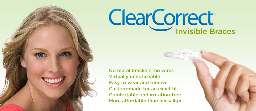 Comfortable and convenient ClearCorrect invisible braces - no metal brackets or wires